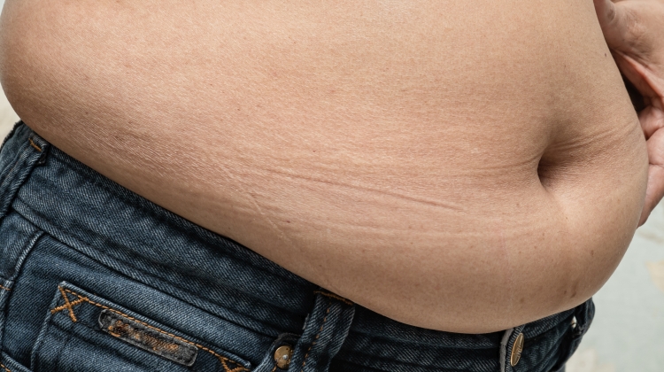 Studiet Reklame Mansion Signal-molekyle tvinger det brunt fedt til øget fedtforbrænding